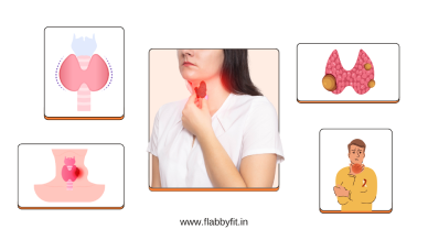 Thyroid Management